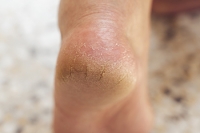 Pretty Feet for Summer