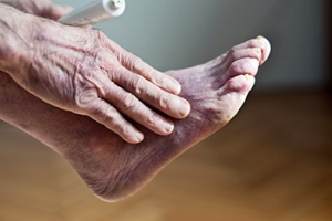 Tests Can Be Performed That May Help to Diagnose Poor Circulation
