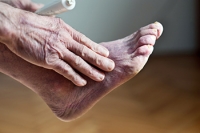 Tests Can Be Performed That May Help to Diagnose Poor Circulation