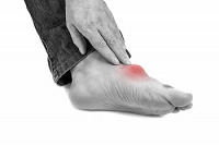 Gout Demystified