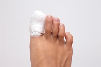 Buddy Taping May Be a Possible Treatment Method