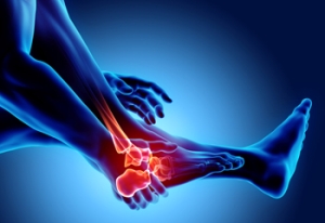 What Is Juvenile Idiopathic Arthritis?